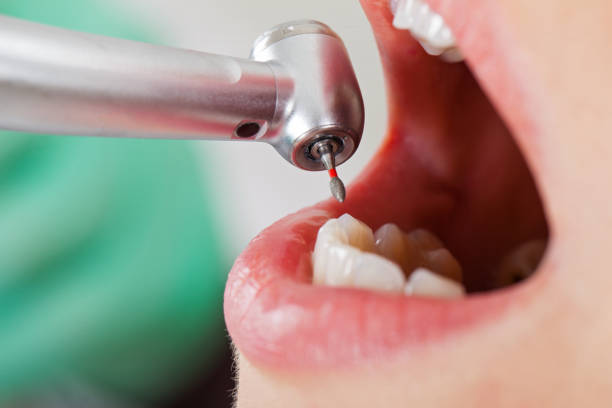 Best Emergency Dental Care for Sports Injuries in Hargill, TX